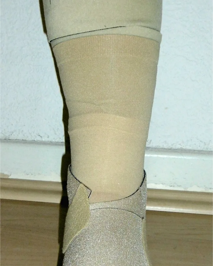 An adjustable hook-and-loop compression wrap fastened around the lower leg