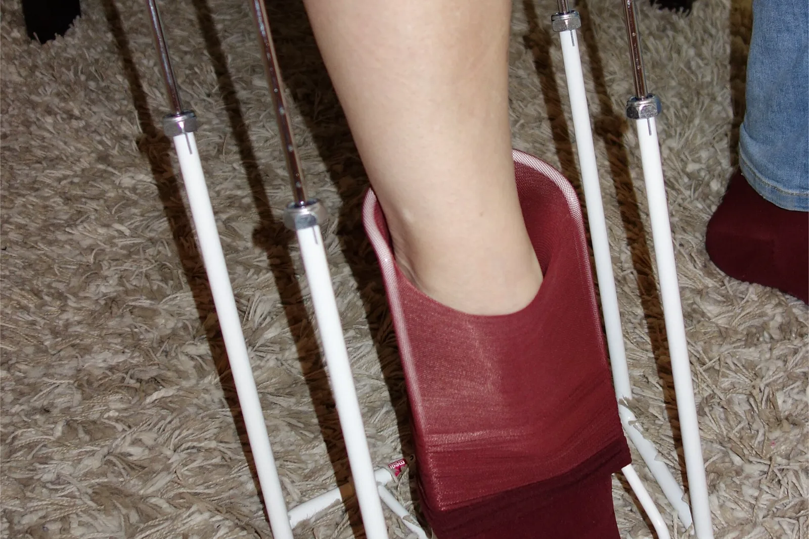 A compression stocking held open on a metal donning frame while a foot steps into it