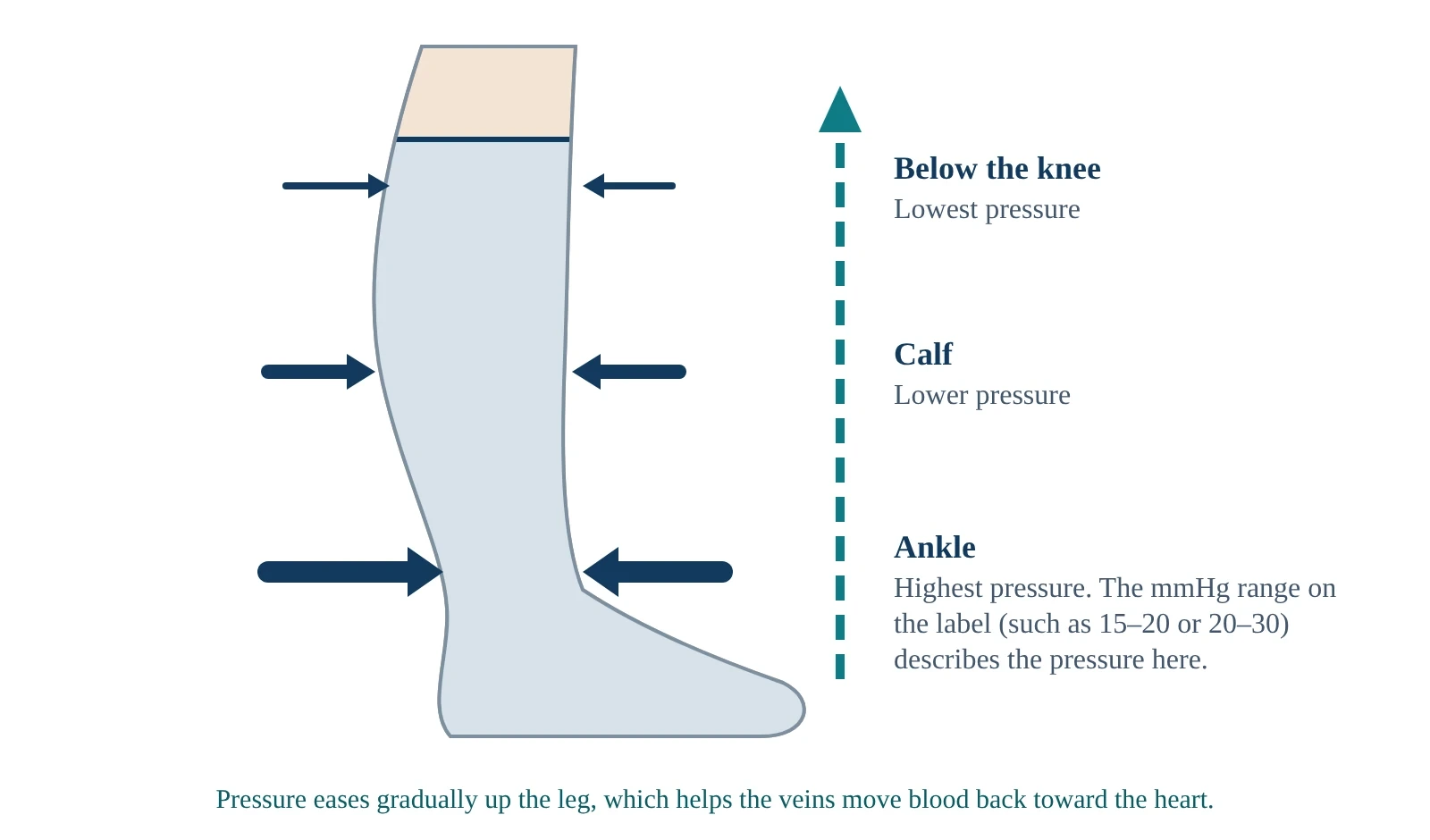 Diagram of a knee-high compression stocking: pressure is highest at the ankle and eases toward the knee